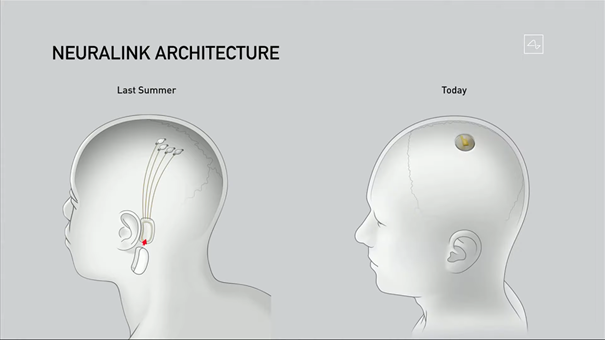 architektura neuralink'a